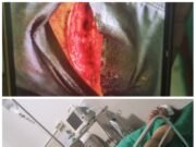 Gawat…!!! Jurnalis Jadi Korban Kekerasan, Ketua IWOI Aceh Mengambil Jalur Hukum