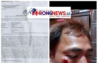 Waduh…!!! Lagi Lagi Jurnalis Jadi Korban Kekerasan, DPW IWO-I Sumsel Kecam Keras Tangkap RL