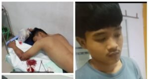 Viral…! Dua Remaja Asal Cikarang Timur Jadi Korban Begal Sadis di Cabangbungin