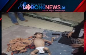 Miris…!!! Muhammad Rizki Firdaus (13) Alami Gizi Buruk, Penanganan Dugaan Stunting Disorot